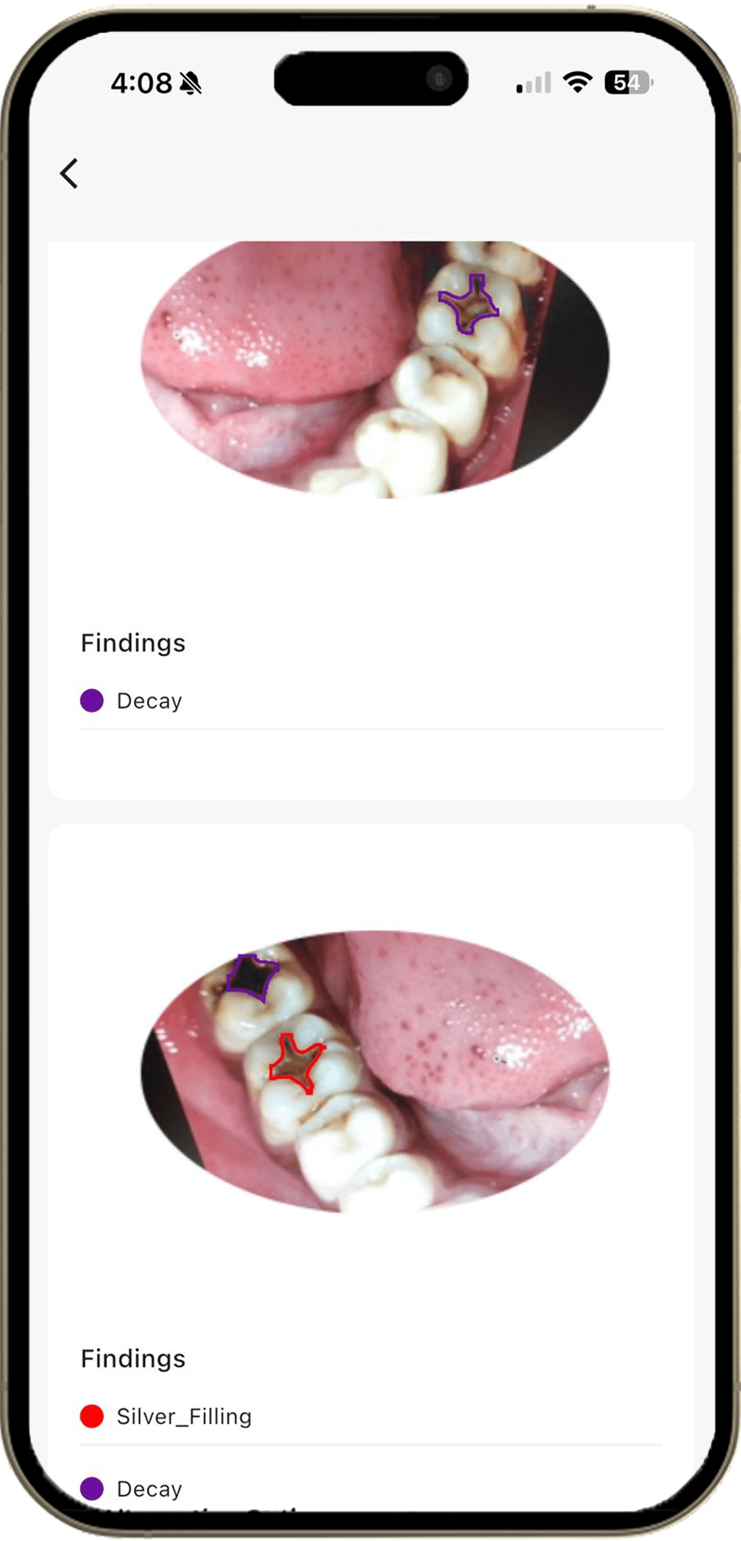 AI-Powered Mouth Image Insights